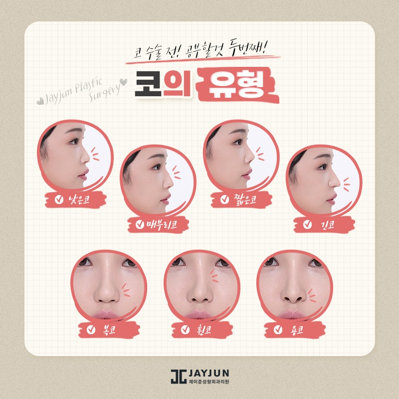 코성형, 꼭 알아야할 정보 모음 관련 이미지 4