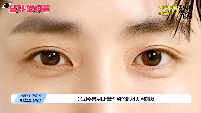 [Jeijun Plastic Surgery & Dermatology] Types and Features of Men’s Double Eyelid Lines Seen Through Celebrities! image 25