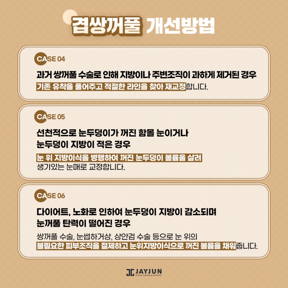 피곤한 인상! 흐릿한 눈매! 제이준 #겹쌍꺼풀 눈성형 관련 이미지 7