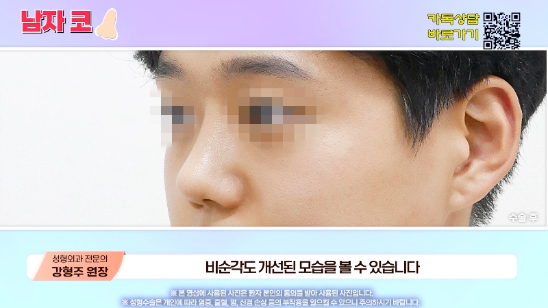 [제이준성형외과&middot;피부과] 남자 인상의 결정적인 부위 관련 이미지 15