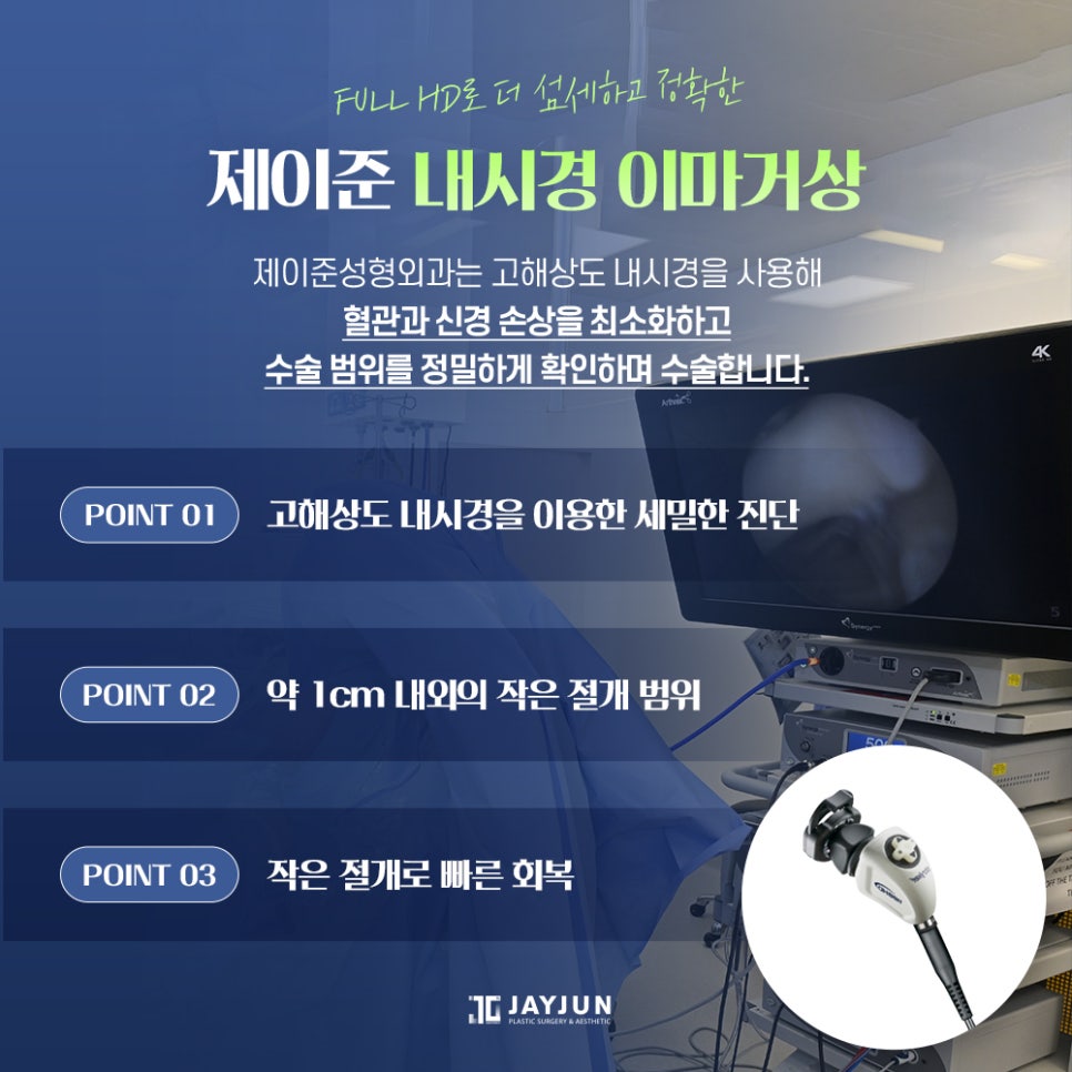 [제이준 성형외과] 이마 주름과 처진 눈매 개선에는! 제이준 중년눈성형 내시경 이마거상 관련 이미지 7