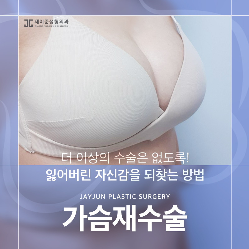 가슴재수술 , 실패 원인에 따른 수술 계획이 중요 관련 이미지 1