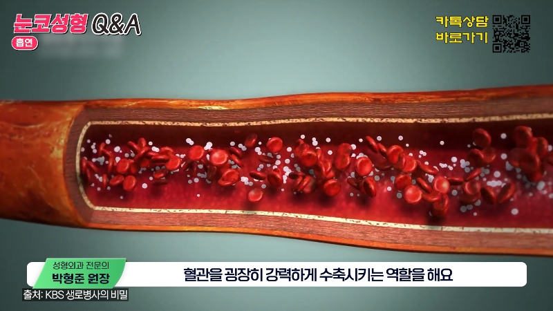 [Jeijun Plastic Surgery & Dermatology] Pre- and Post-Op Q&A: The Must-Know Guide to Eye and Nose Surgery! image 25