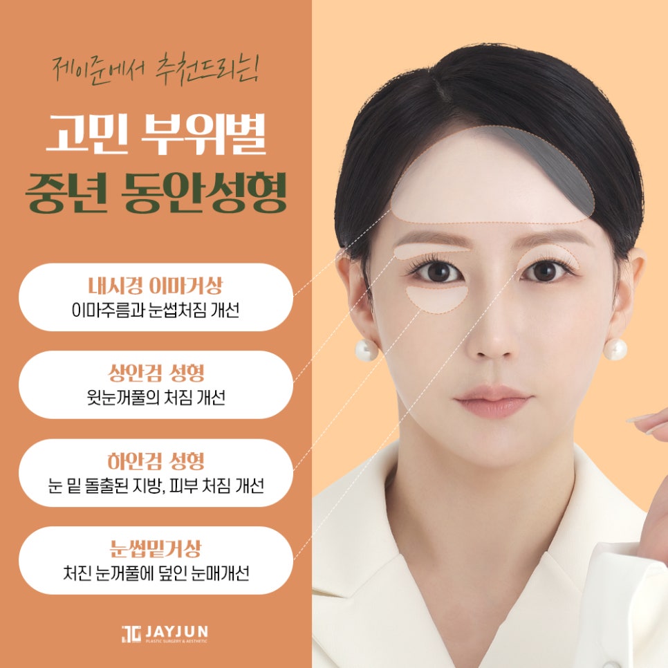 [제이준성형외과] 주름개선과 동안눈매를 한번에! 중년눈성형 눈썹밑거상 관련 이미지 3