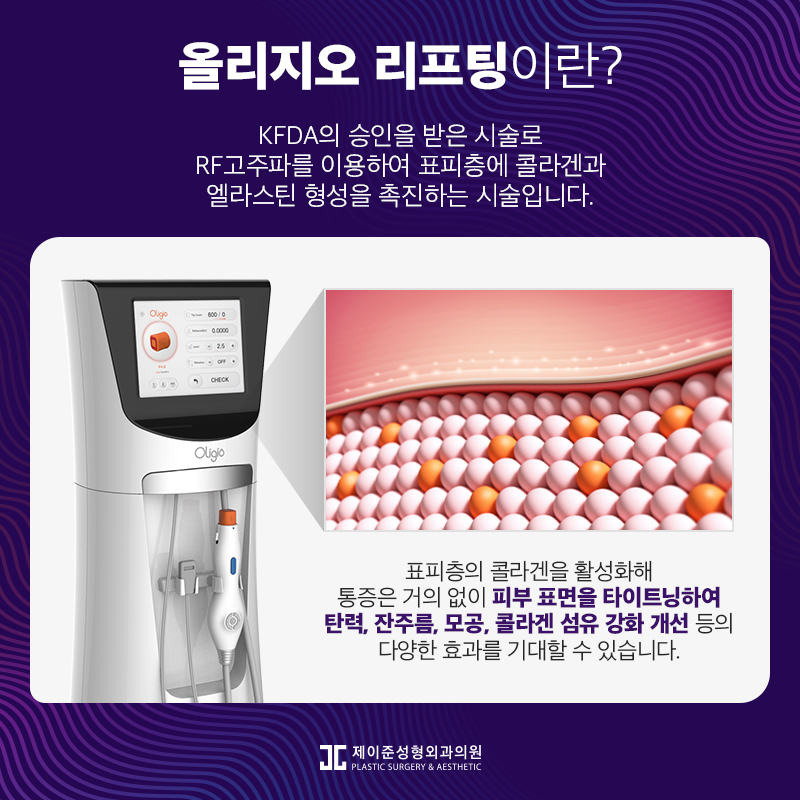 탄력잃고 처진 얼굴에는 올리지오리프팅 관련 이미지 2