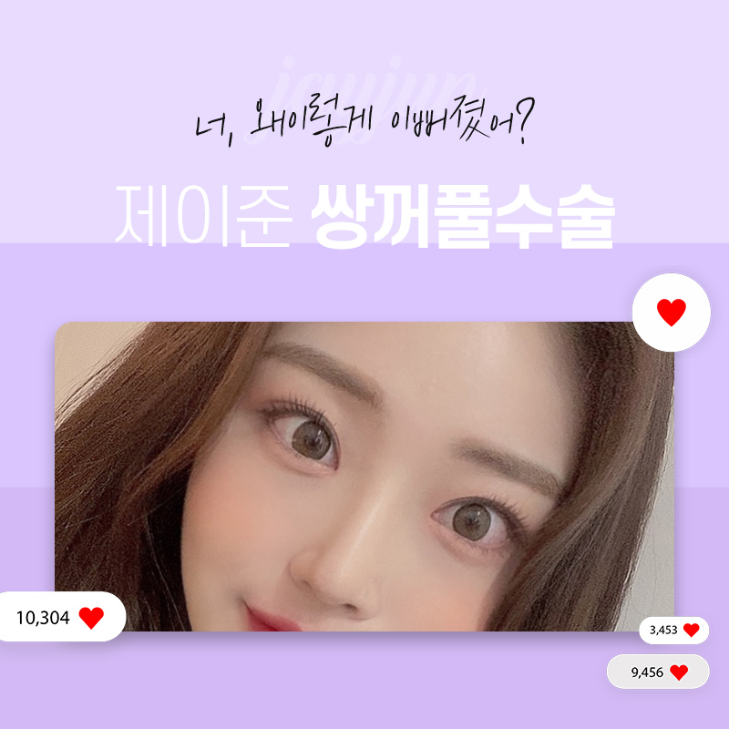 [제이준성형외과] 강남역 쌍수,  자연스러운 변화를 얻으려면? 관련 이미지 7
