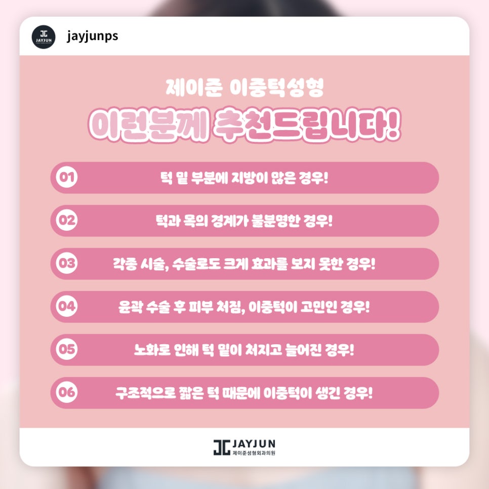 한번에 확실하게! 제이준 이중턱 지방흡입 & 근육묶기 관련 이미지 5