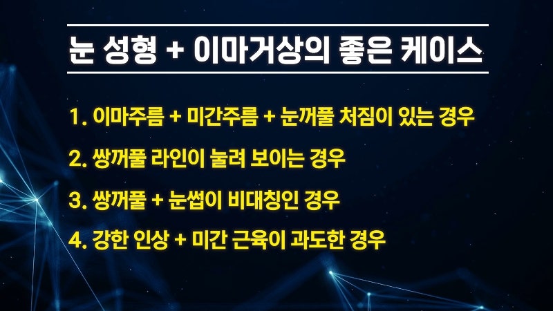 [제이준 유튜브] 쌍수 하러  갔는데 이마거상을 추천하는 이유?! 관련 이미지 13