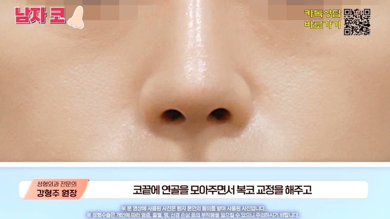 [제이준성형외과&middot;피부과] 남자 인상의 결정적인 부위 관련 이미지 19