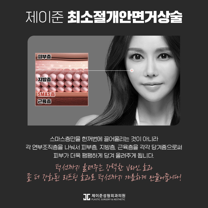 최소절개안면거상술 어떤 수술일까? 관련 이미지 5