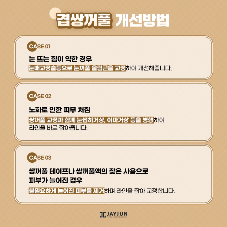 피곤한 인상! 흐릿한 눈매! 제이준 #겹쌍꺼풀 눈성형 관련 이미지 6