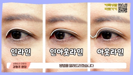 [제이준성형외과&middot;피부과] 내 눈에 찰떡인 쌍꺼풀 라인! 미리 찾아보기👀 관련 이미지 4