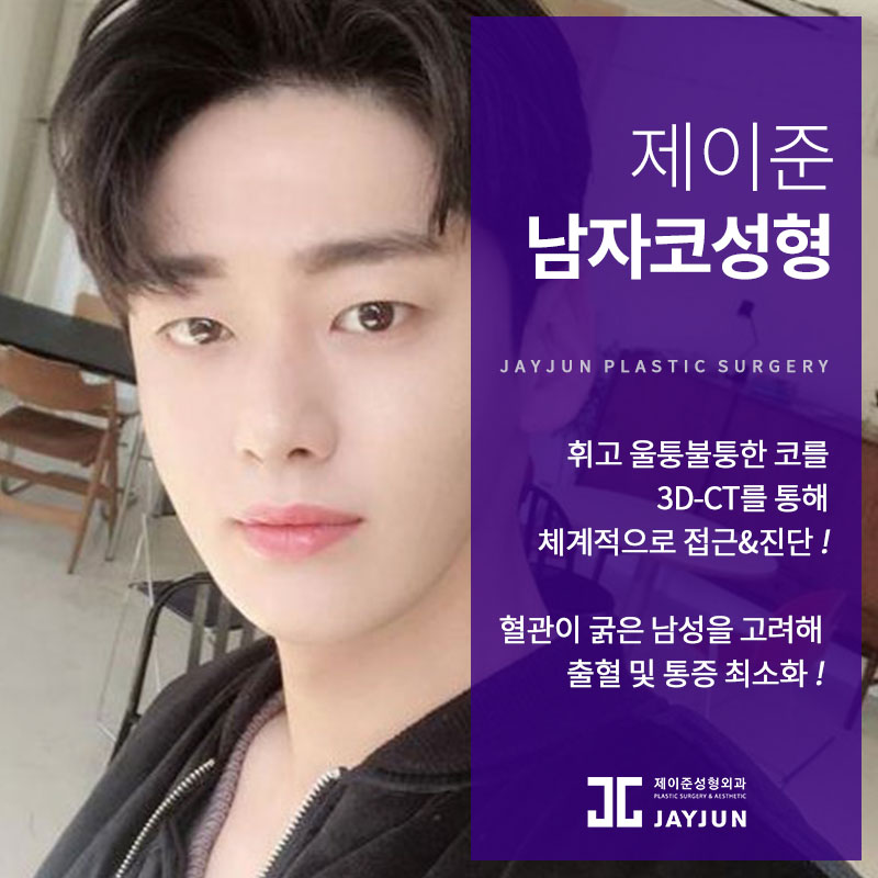 남자코성형으로 유명한 이유, 제이준성형외과는 유형에 따라 솔루션이 달라지니까! 관련 이미지 1
