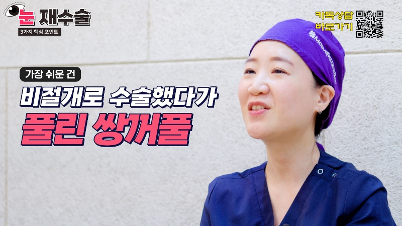 [제이준 유튜브] 눈 재수술을 막기위한 3가지 포인트! 관련 이미지 13