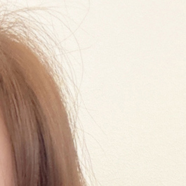 상안검과 하안검이란? 관련 이미지 13