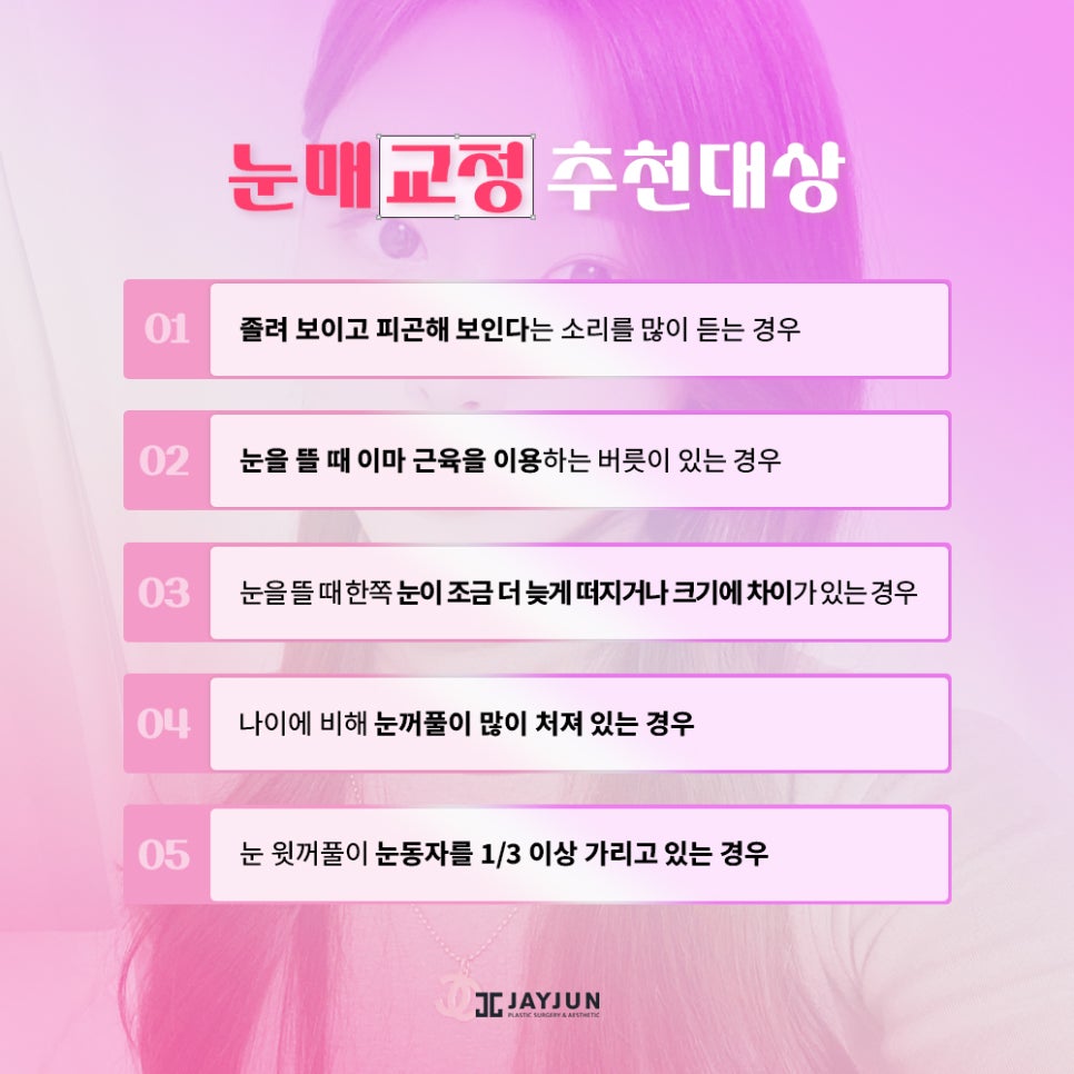생기있고! 또렷하게! 제이준 눈매교정 관련 이미지 3