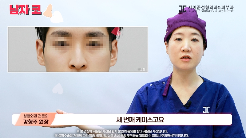 [제이준성형외과&middot;피부과] 남자 인상의 결정적인 부위 관련 이미지 22
