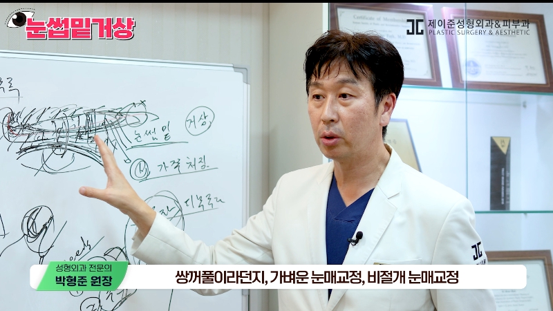 [제이준성형외과&middot;피부과] 쌍꺼풀 라인 변화 없이 눈매 개선은 확실하게! #눈썹밑거상 관련 이미지 20