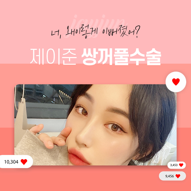 [제이준성형외과] 강남역 쌍수,  자연스러운 변화를 얻으려면? 관련 이미지 8