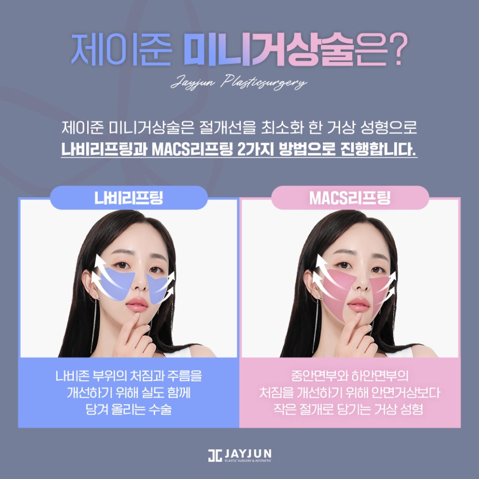#중안면부 #나비존 #최소절개리프팅 제이준 나비리프팅 관련 이미지 4