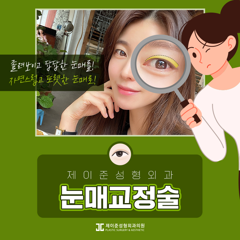 또렷한 눈을 위한 눈매교정 알아보기 관련 이미지 1