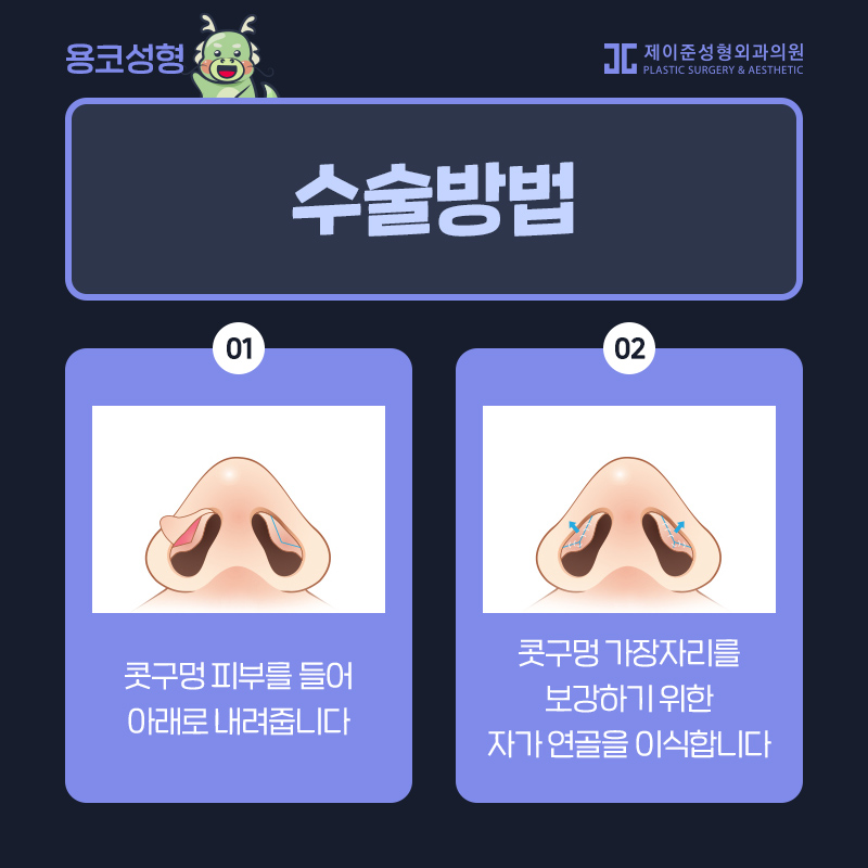 용코성형 찾으신다면? 관련 이미지 4