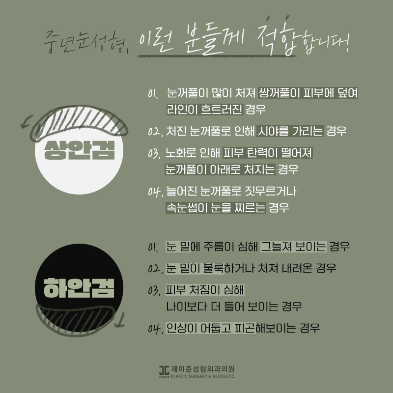 상안검과 하안검이란? 관련 이미지 5