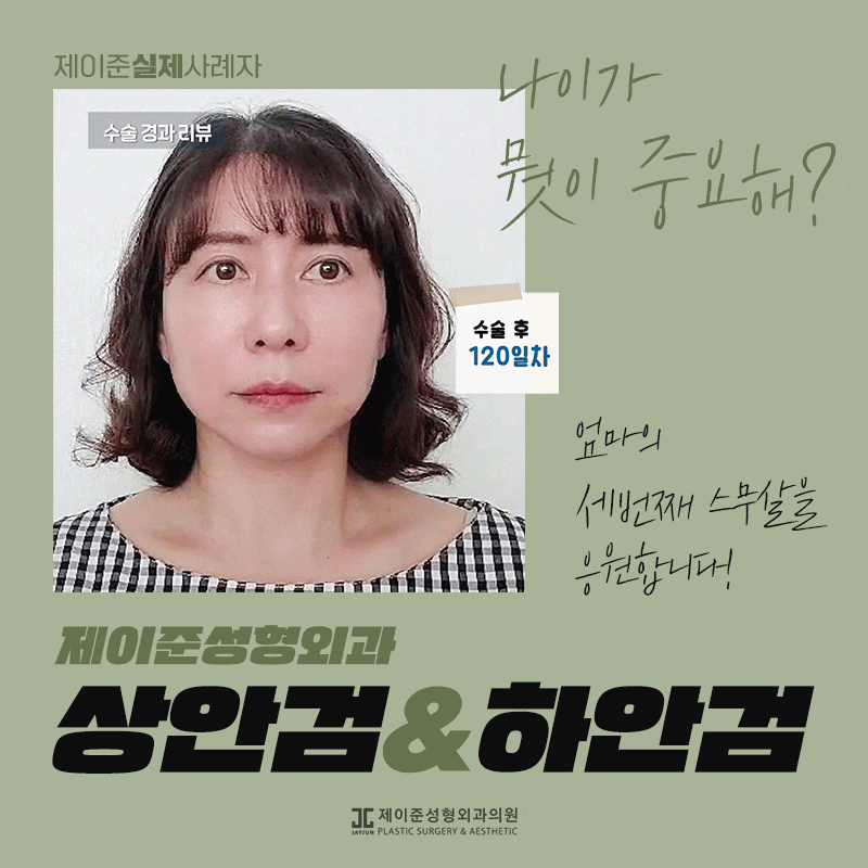 상안검과 하안검이란? 관련 이미지 1