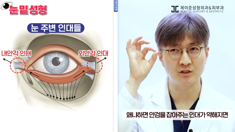 [Jeijun Plastic Surgery & Dermatology&middot;] Lower Blepharoplasty? Lower Eyelid Fat Repositioning? Read This Before Deciding! image 12