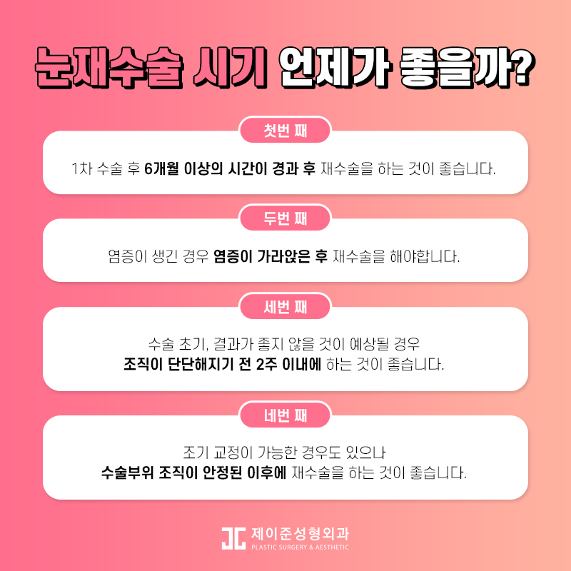 두번의 실패는 없을 제이준성형외과 눈재수술 관련 이미지 3