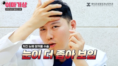 [제이준 유튜브] 쌍수 하러  갔는데 이마거상을 추천하는 이유?! 관련 이미지 3