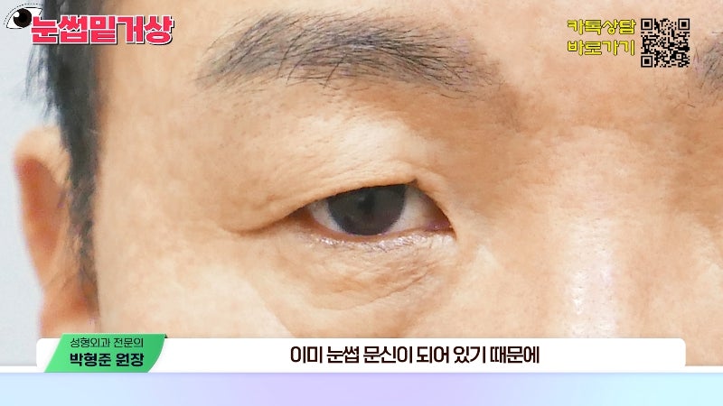 [Jayjun Plastic Surgery & Dermatology] Worried about drooping eyelids? Solve sagging eyes with a brow lift under the eyebrows without double eyelid surgery! image 19