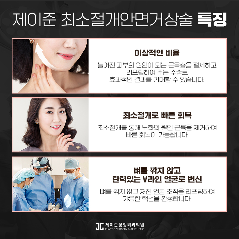 최소절개안면거상술 어떤 수술일까? 관련 이미지 6