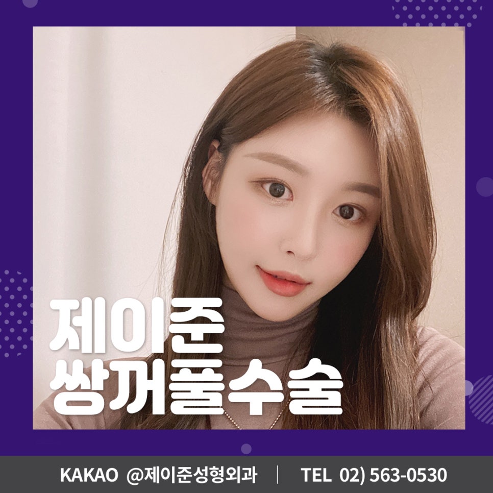 [제이준성형외과] 강남역 쌍수,  자연스러운 변화를 얻으려면? 관련 이미지 1