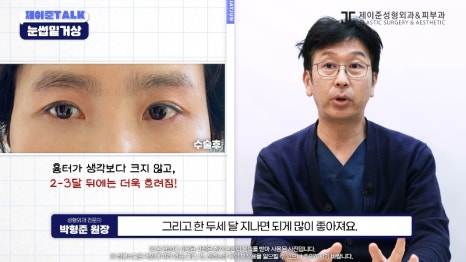 [Jaejune Plastic Surgery & Dermatology] The Secret to a Cleaner Eye Area Without Looking Obvious. #BrowboneLift image 24