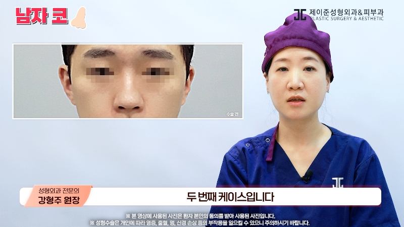[제이준성형외과&middot;피부과] 남자 인상의 결정적인 부위 관련 이미지 16