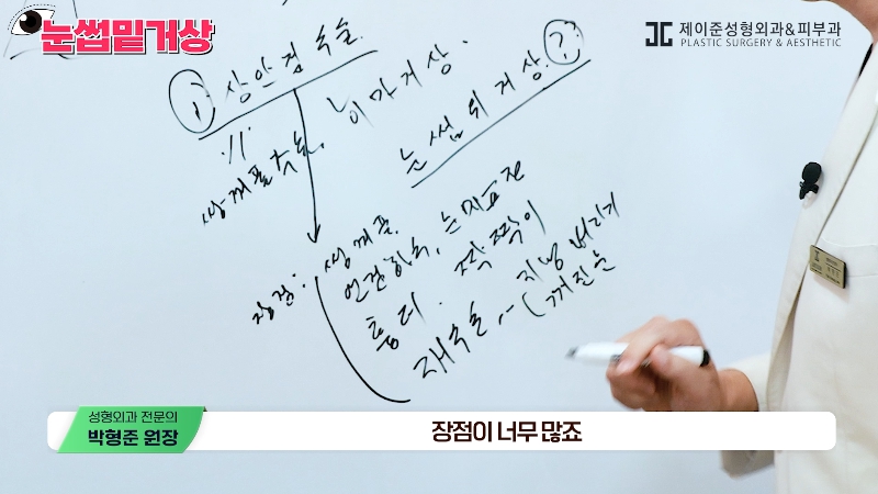 [제이준성형외과&middot;피부과] 쌍꺼풀 라인 변화 없이 눈매 개선은 확실하게! #눈썹밑거상 관련 이미지 10