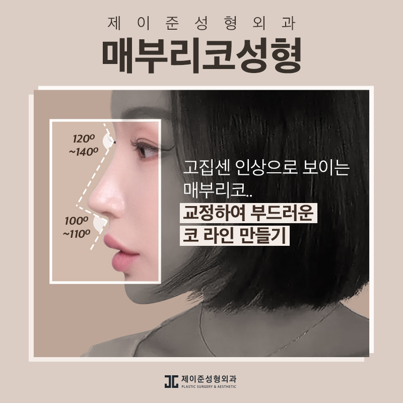 매부리코 교정 , 유형과 상태에 따라 진행돼야 관련 이미지 1