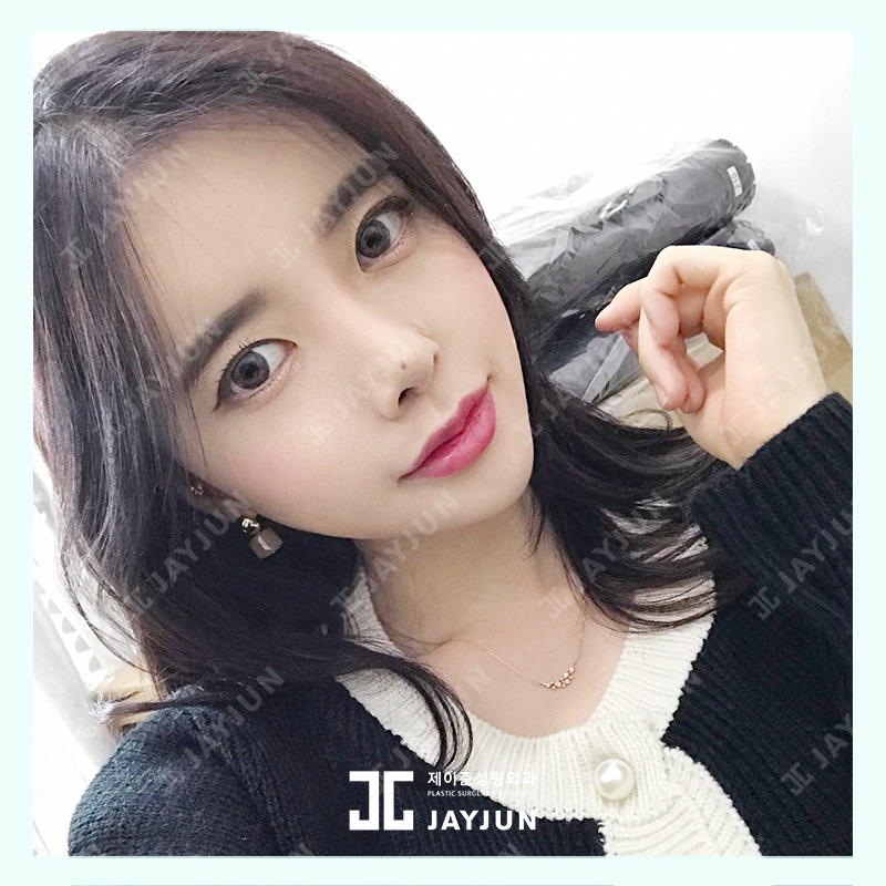 제이준성형외과 관련 이미지 5