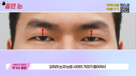 [제이준성형외과&middot;피부과] 졸려보이는 눈과 이마 주름의 상관관계? 관련 이미지 19