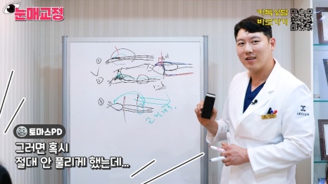 [제이준성형외과&middot;피부과] 눈매교정 파헤치기! 하나부터 열까지 싹~ 알려드립니다! 관련 이미지 9