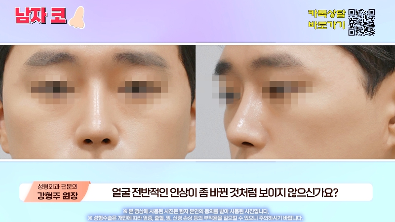 [제이준성형외과&middot;피부과] 남자 인상의 결정적인 부위 관련 이미지 21