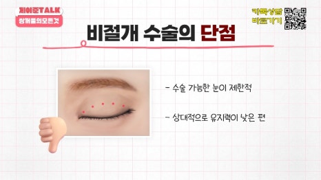[제이준성형외과&middot;피부과] 비절개&middot;부분절개&middot;절개 쌍꺼풀의 원리와 차이점! 관련 이미지 8