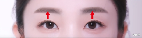 [강남눈성형] 눈성형하러갔는데 이마거상 추천하는 이유 관련 이미지 10