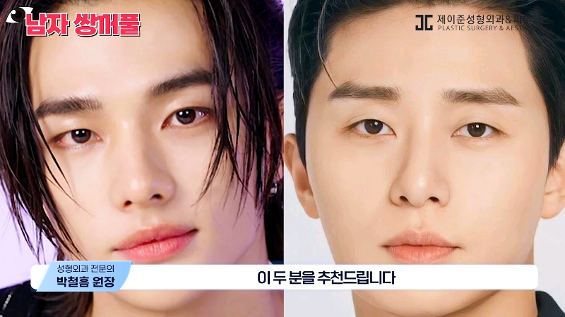 [Jeijun Plastic Surgery & Dermatology] Types and Features of Men’s Double Eyelid Lines Seen Through Celebrities! image 5