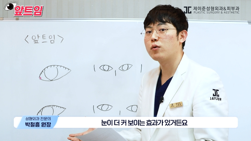 [Jaejune Plastic Surgery & Dermatology] Why is epicanthoplasty necessary? Everything about epicanthoplasty!! image 11