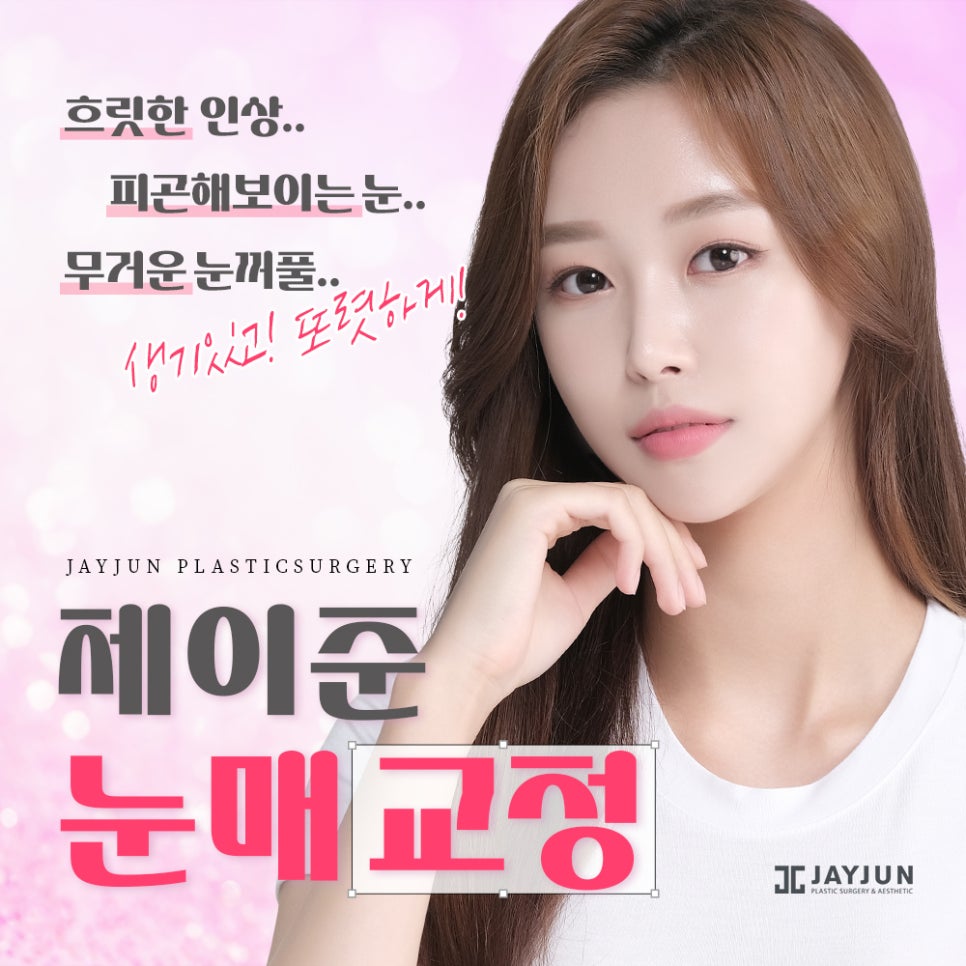 생기있고! 또렷하게! 제이준 눈매교정 관련 이미지 1
