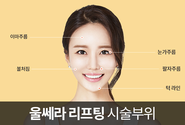 제이준피부과 처진눈, 눈가주름 은 관련 이미지 3