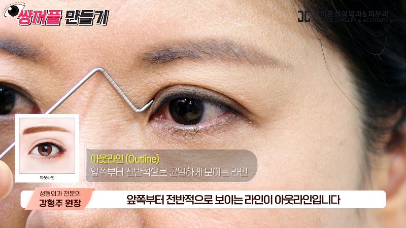 [제이준성형외과&middot;피부과] 내 눈에 찰떡인 쌍꺼풀 라인! 미리 찾아보기👀 관련 이미지 10