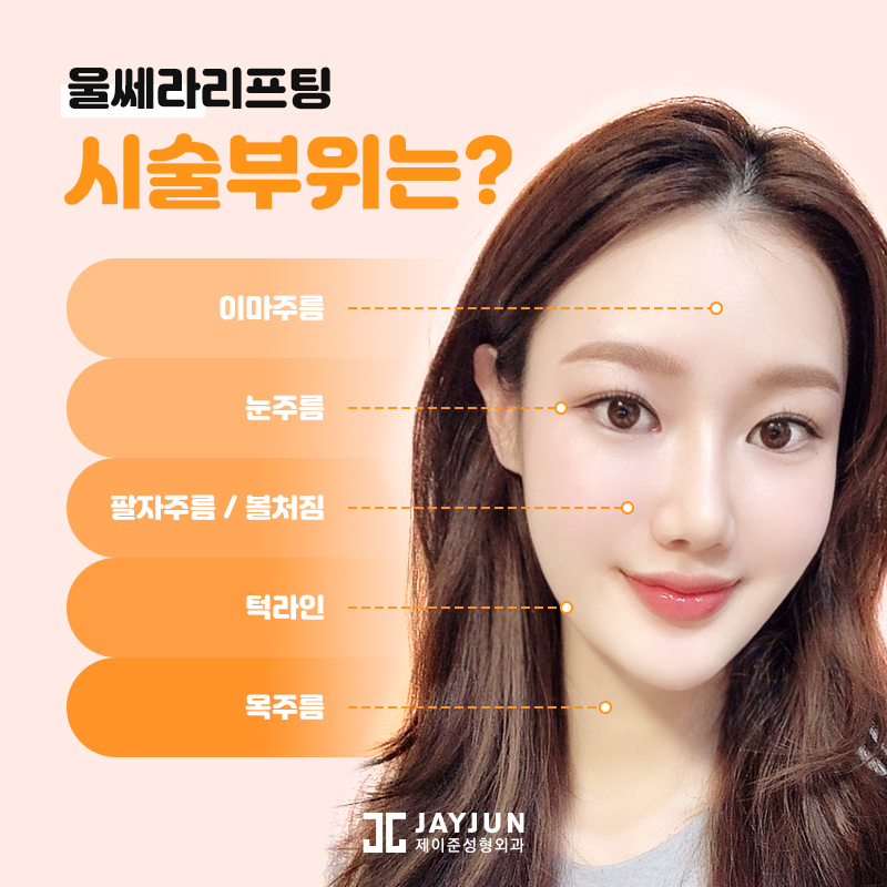 레이저리프팅! 울쎄라, 써마지, 올리지오 알아보기 관련 이미지 6